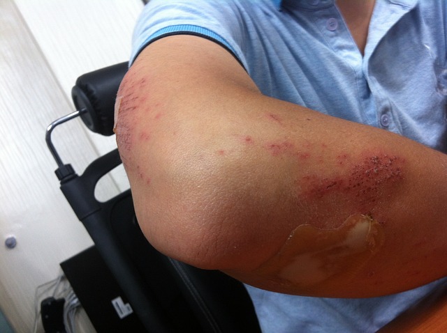 Seeking Justice for Injuries in Peoria: Your Guide to Compensation