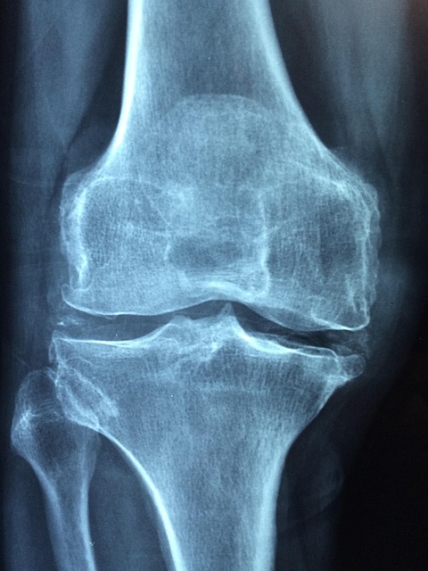 Peoria Injury
