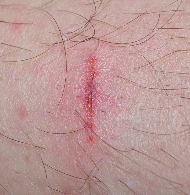 Justice for Peoria Injury Victims: Navigating Legal Paths to Compensation