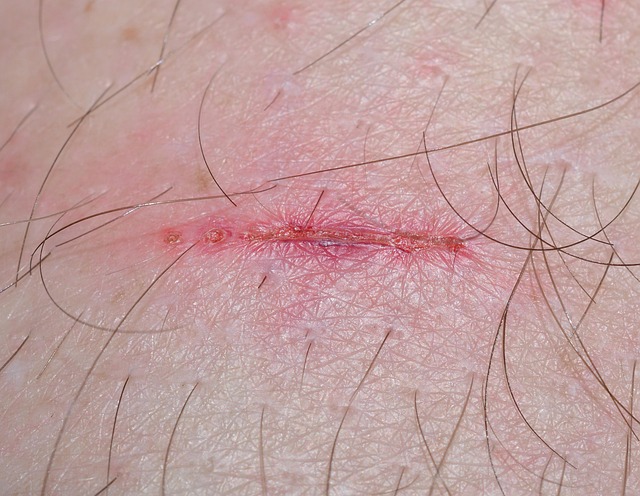 Peoria Injury
