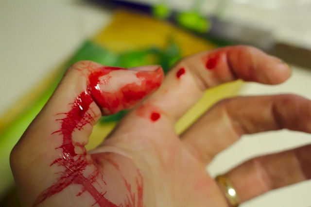 Peoria Injury
