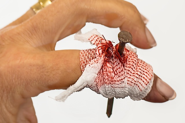 Peoria Injury Lawsuit