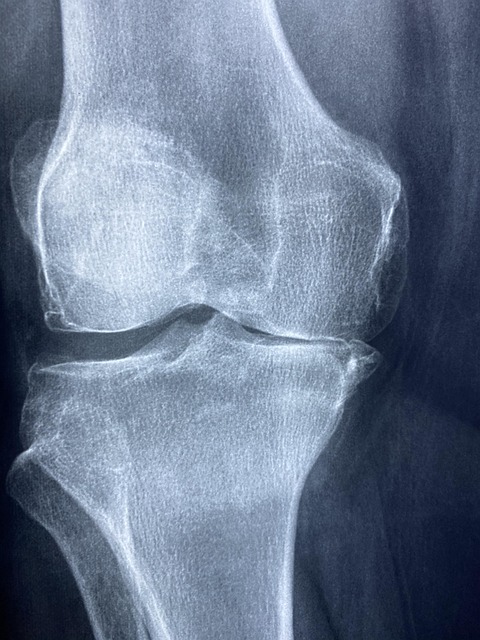 Peoria Personal Injury