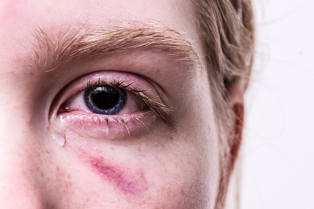 Peoria Personal Injury Lawyer
