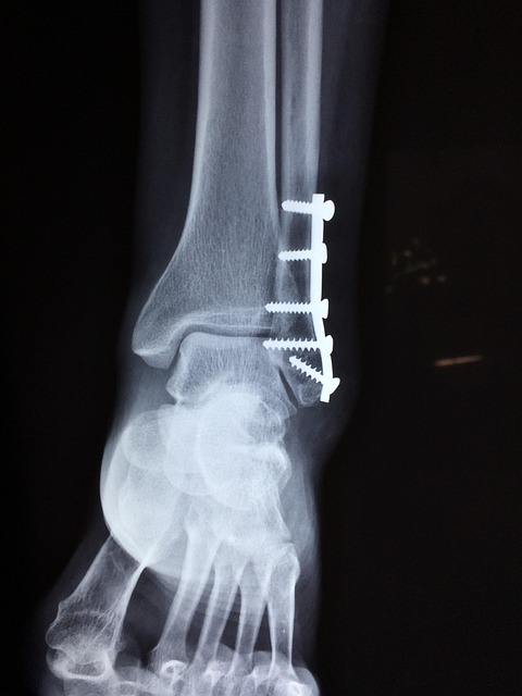 Peoria Injury